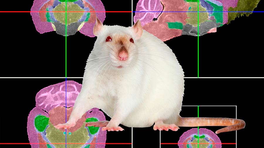 Exceso de glucosa causa problemas de colesterol